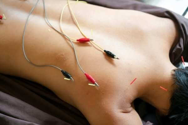 Mujer acostada boca abajo en una camilla de masaje con cables para electroterapia sobre su espalda descubierta.